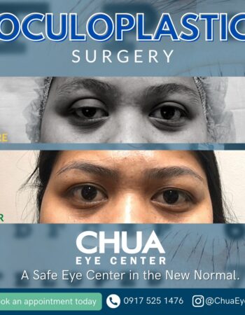 Chua Eye Center