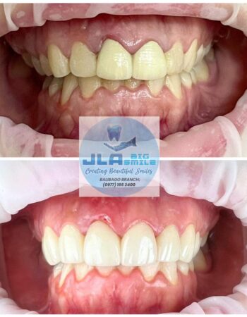 JLA Big Smile Dental Clinic –  Balibago